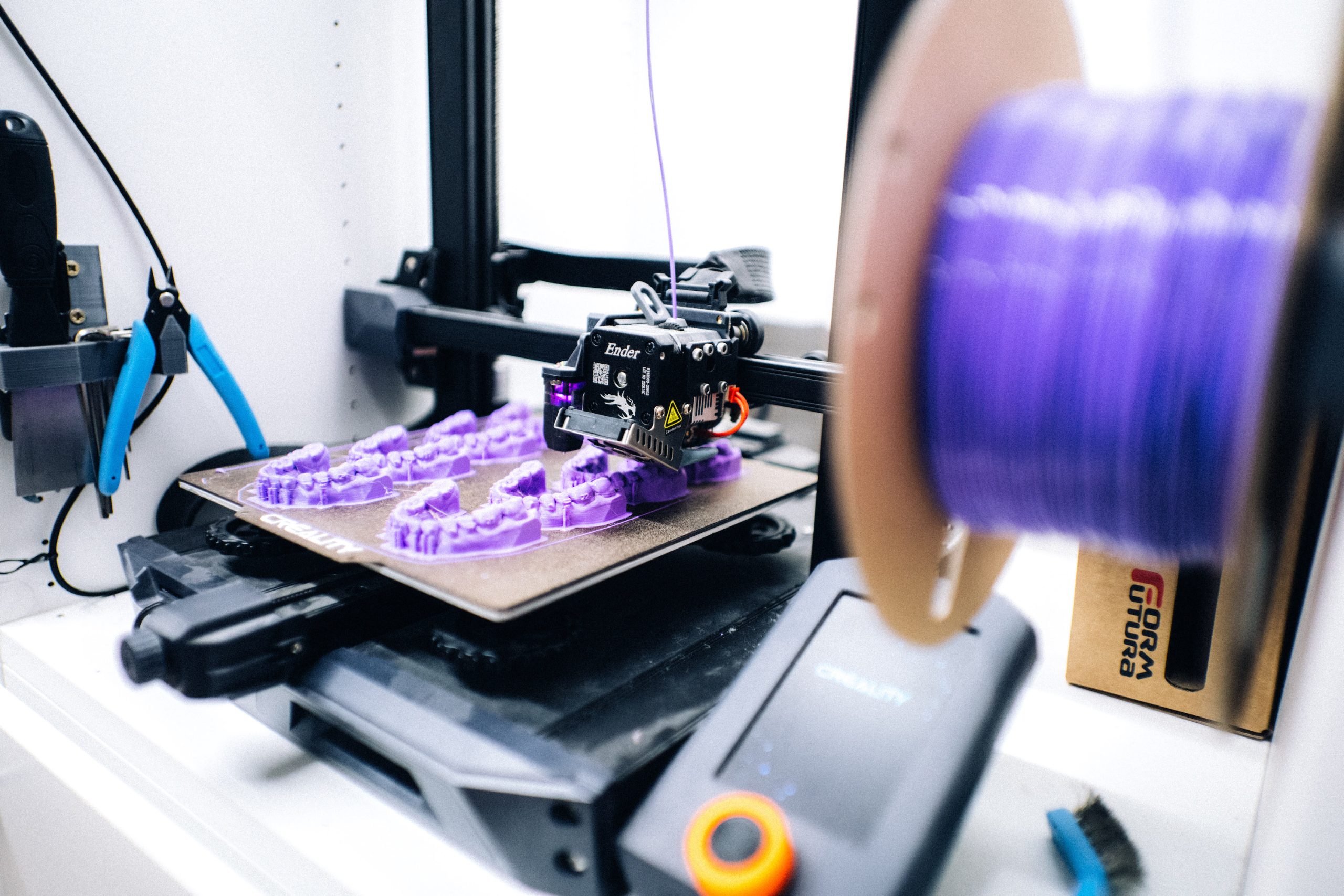 3D-gedruckte Knirscherschiene, Aufbissschiene und individueller Mundschutz aus dem eigenen Meisterlabor von edel & weiss Zahnärzte Nürnberg