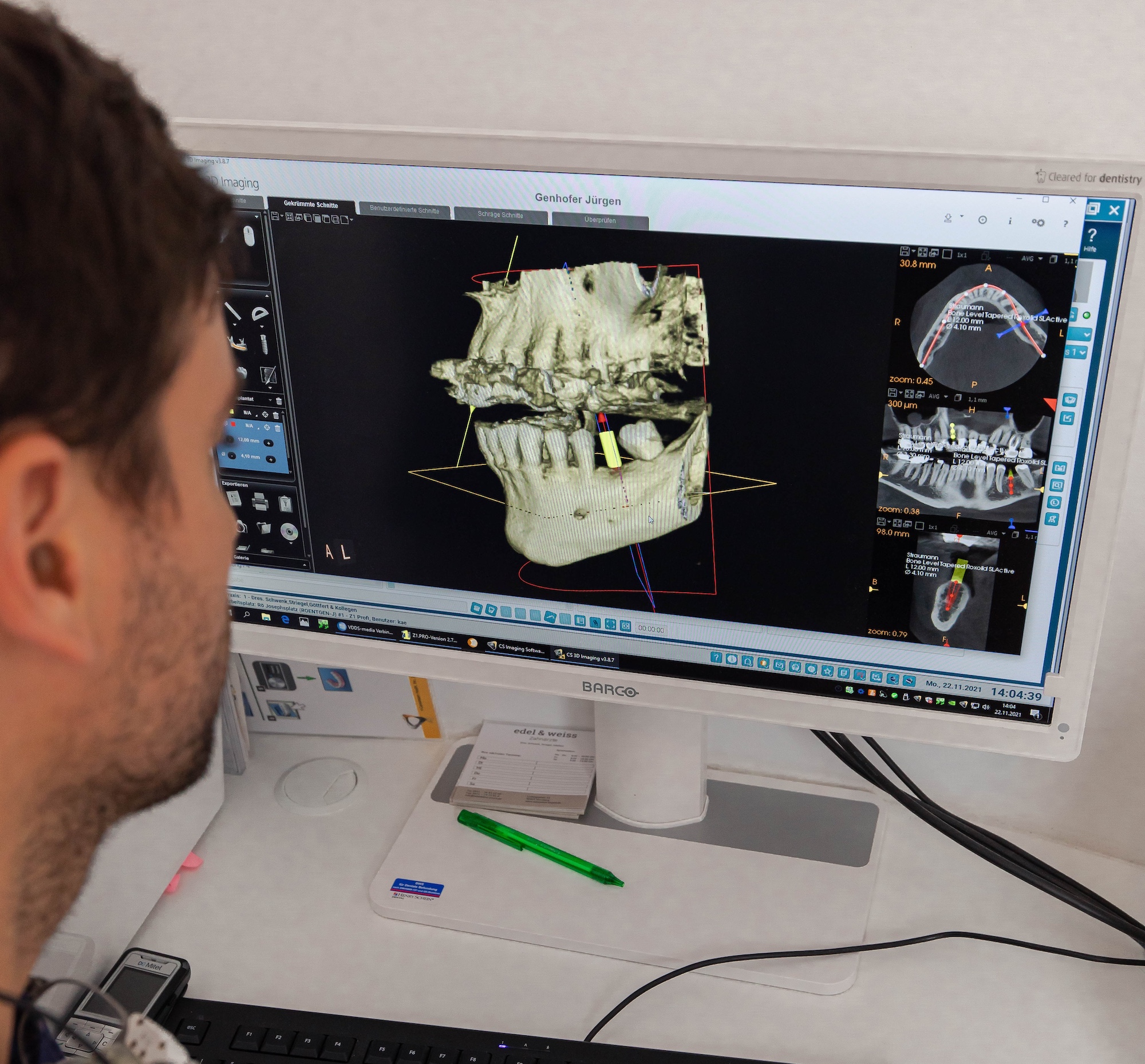 Dr. Andrea Savo bei oralchirurgischer Behandlung mit digitaler Zahnmedizin und Narkoseoptionen in Nürnberg