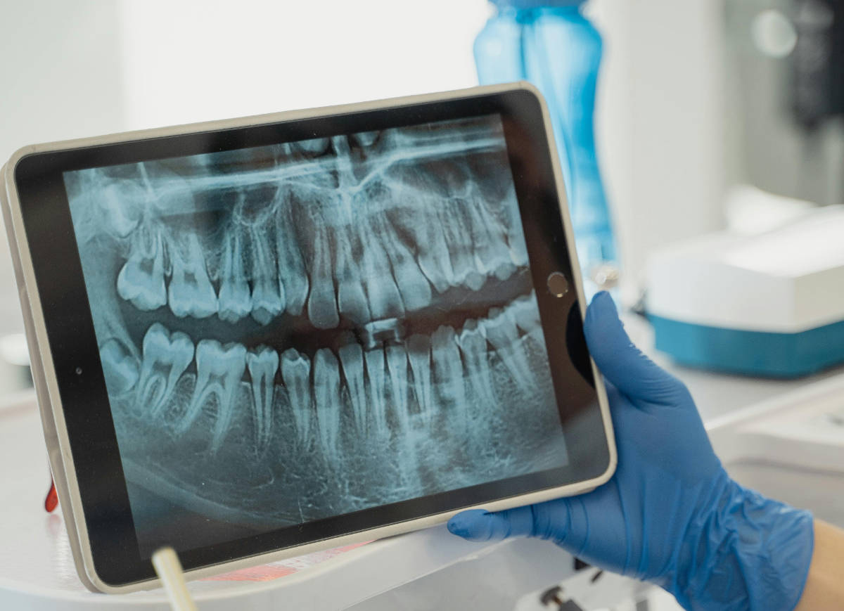 Röntgenaufnahme Kiefergelenk für CMD-Diagnostik