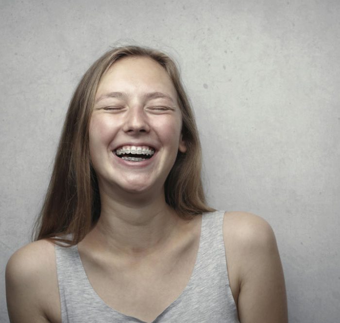 Teenager lächelt mit fester Zahnspange und Retainer bei kieferorthopädischer Behandlung in Nürnberg (KFO)